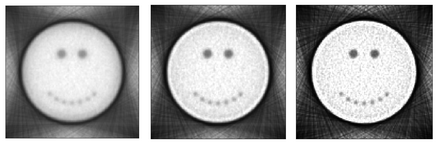 A smile reconstructed with Richardson–Lucy Algorithm